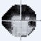 visualFields Easy is designed to use the iPad screen to perform a fast screening test of the visual fields (peripheral vision)