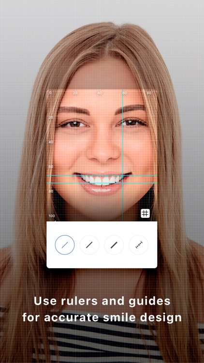 iSmileStudio Lite