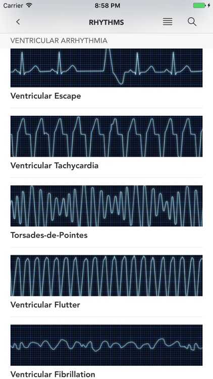 Instant ECG: An Electrocardiogram Rhythms Guide