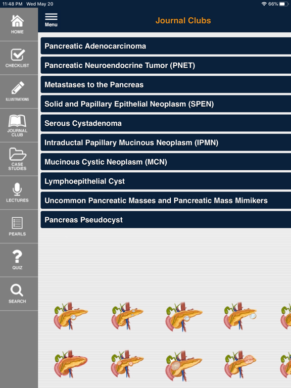 CTisus Pancreas Compendiumのおすすめ画像3