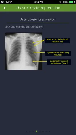 Game screenshot Chest Radiographs hack