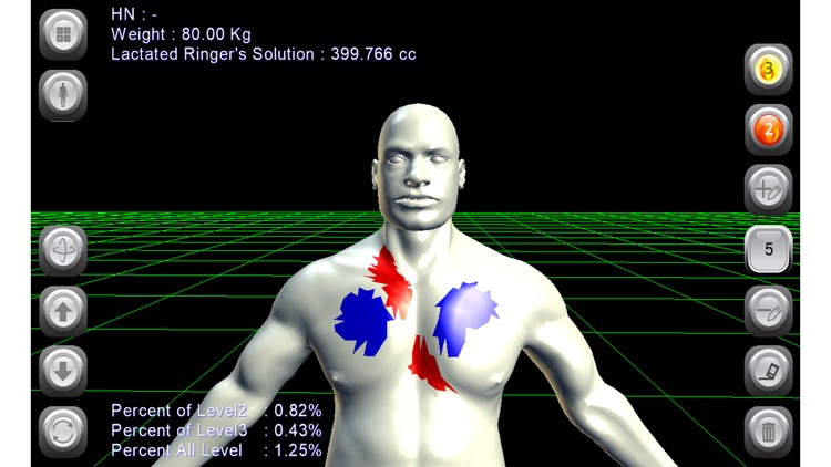 3D Burn Resuscitation screenshot-0