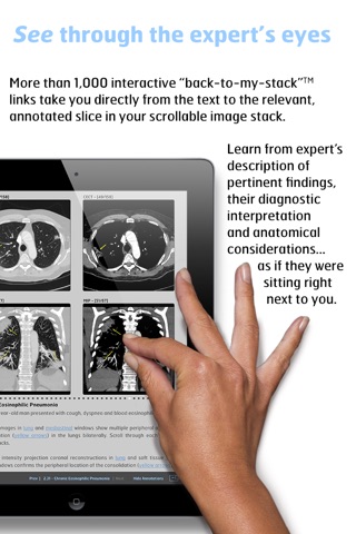 Radiology - Thoracic Imaging screenshot 4