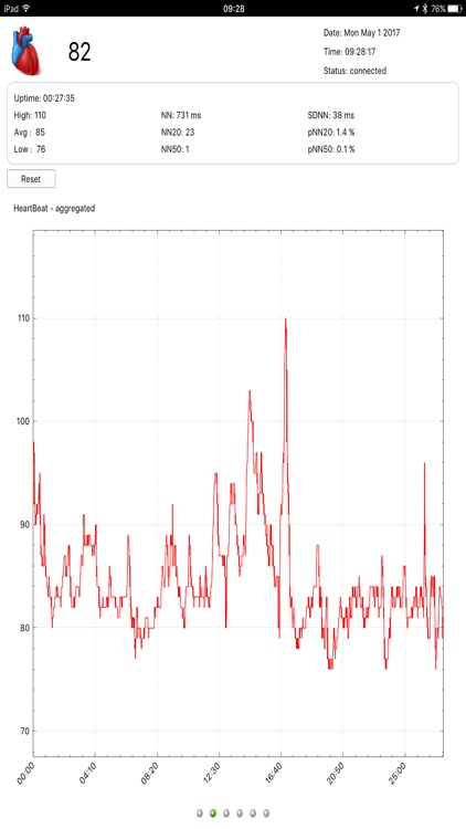 HeartBeat Visualisation