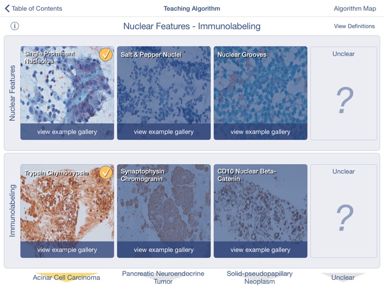 Johns Hopkins Atlas of Pancreatic Cytopathology screenshot-3