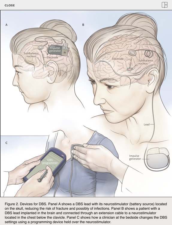 NEJM iPad Edition