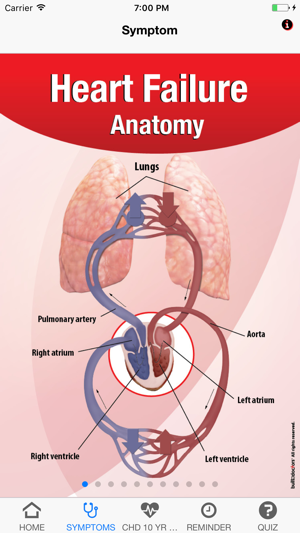 Signs & Symptoms Heart Failure(圖2)-速報App