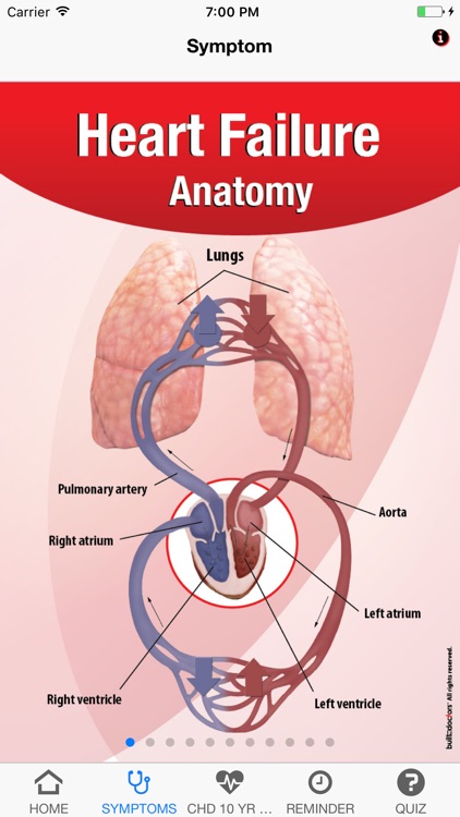 Signs & Symptoms Heart Failure