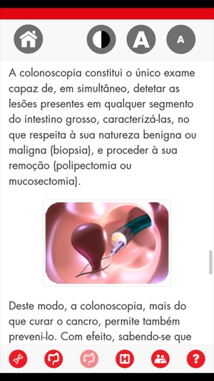 Cancro Colorretal(圖3)-速報App