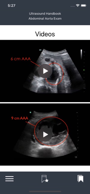 Emergency Ultrasound Handbook(圖4)-速報App