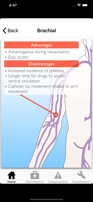 Catheter Pro(圖2)-速報App