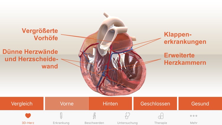 Herzstark in 3D screenshot-3