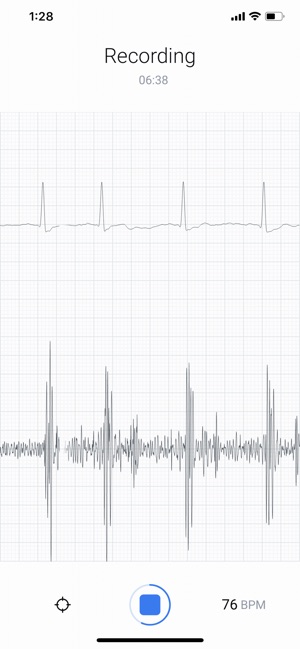 Eko: Digital Stethoscope + ECG(圖3)-速報App