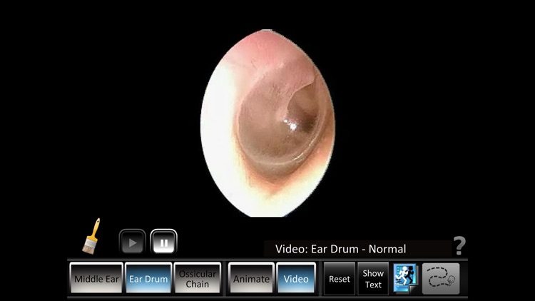 Middle Ear ID screenshot-4