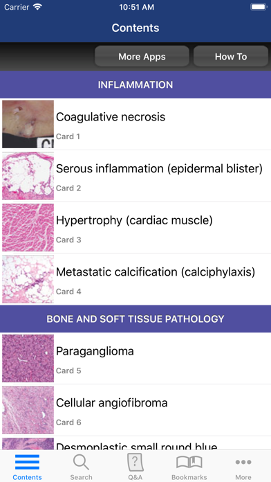 How to cancel & delete Anatomic Pathology Flashcards from iphone & ipad 2