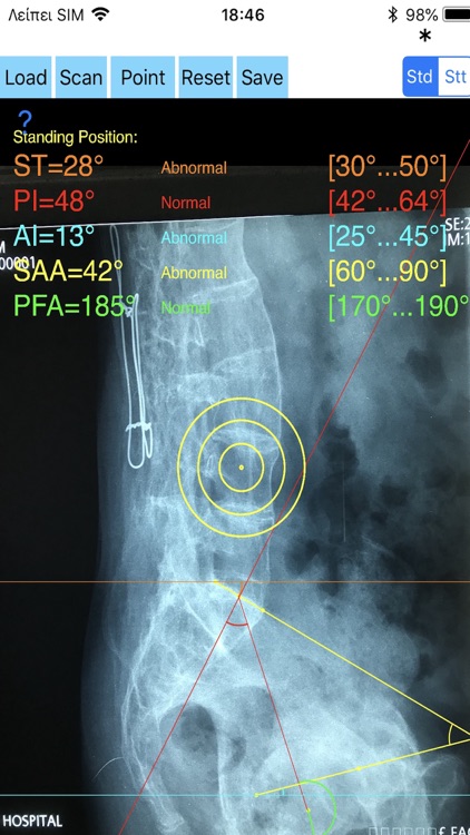 SpinopelvicMobilityApp screenshot-7