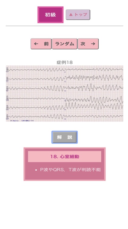 ポケット心電図 screenshot-3