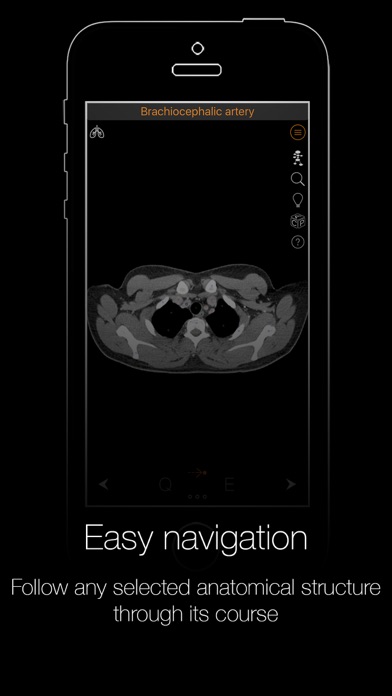 CT Anatomyのおすすめ画像5