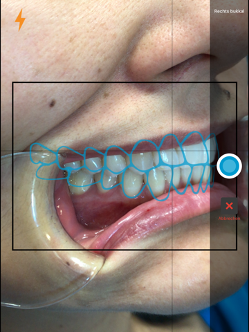 Invisalign Photo Uploader screenshot 4