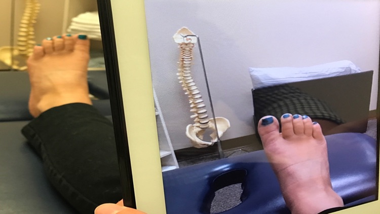 Mirror Box: CRPS & RSD, Stroke screenshot-3