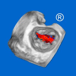 CARDIO3®3D Echocardiography HD