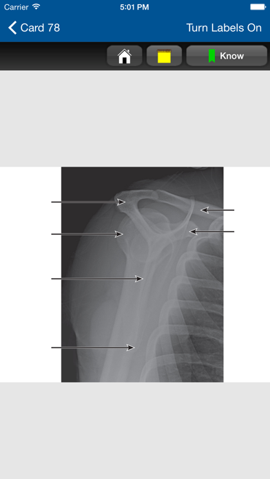 How to cancel & delete Radiographic Positioning Cards from iphone & ipad 4