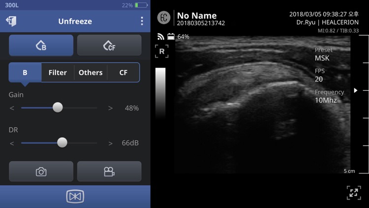 SONON Ultrasound App KR