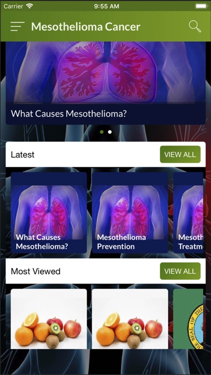 Mesothelioma Cancer -  Lawyer