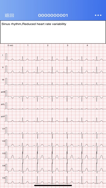 CaRDIaRT ECG screenshot-3