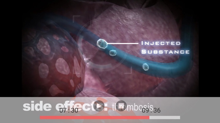 Ice - Your Body Belongs to You