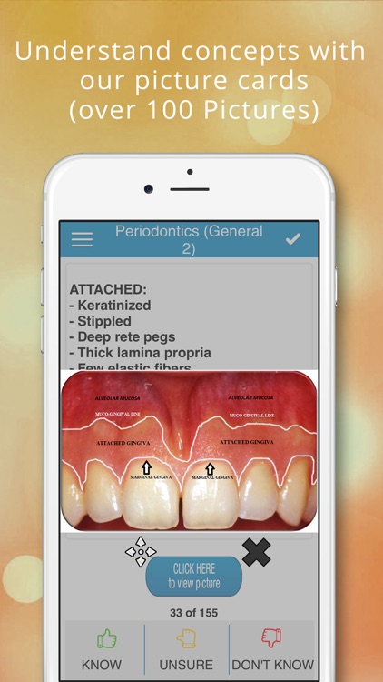 ADAT Periodontics Cram Cards