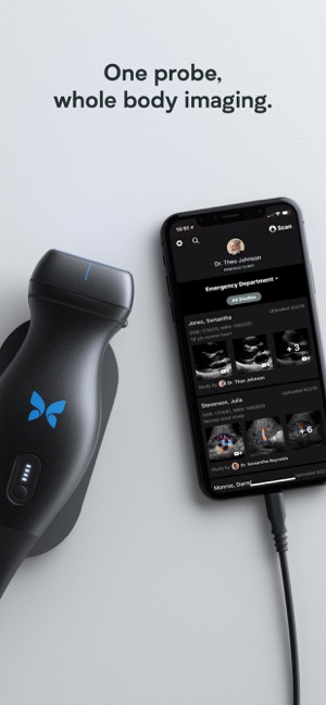 Butterfly iQ — Ultrasound(圖1)-速報App