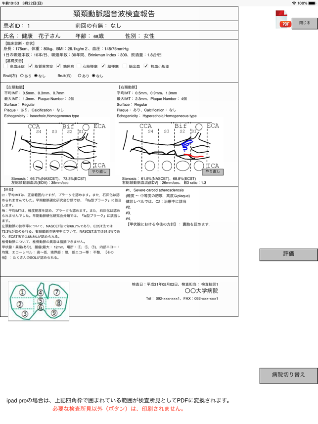 US-carotid(圖9)-速報App