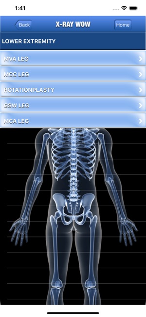 X-Ray Wow(圖3)-速報App