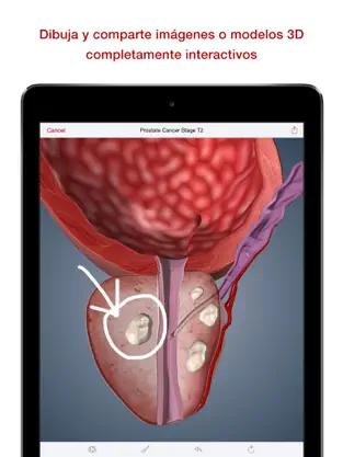Screenshot 5 BioDigital Human - Anatomía 3D iphone
