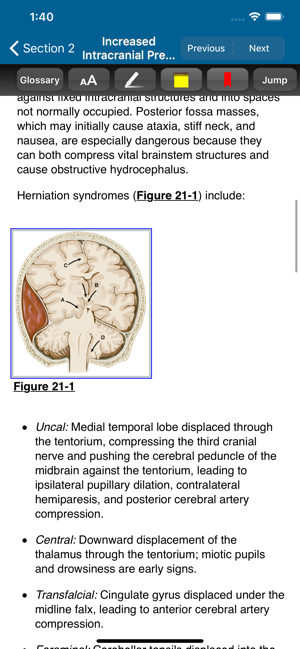 Harrison’s Manual of Med. 20/E(圖6)-速報App