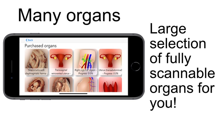 Scanbooster Ultrasound Sim screenshot-4