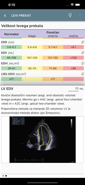 EhoKardio(圖1)-速報App