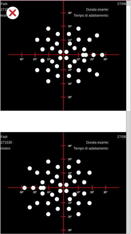 MyVisualField Test screenshot-5