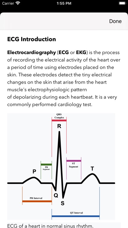 ECG / EKG screenshot-9