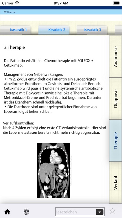 Case App mCRC screenshot-4