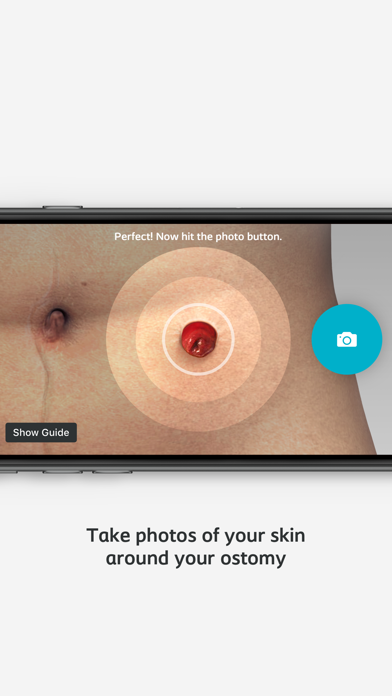 Ostomy Skin Care screenshot 4