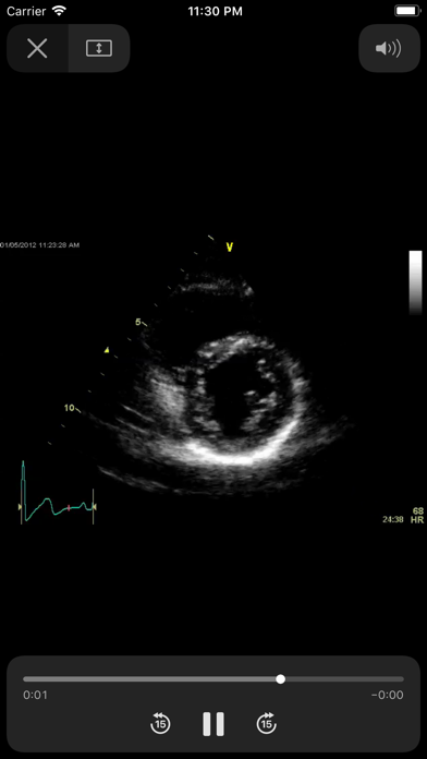 EchoSource screenshot1