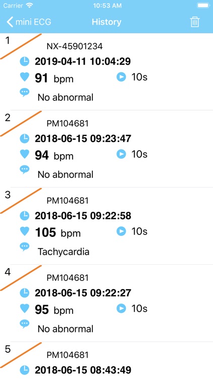 mini ECG