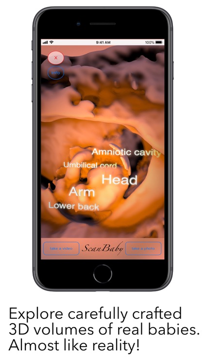 ScanBaby learn baby ultrasound screenshot-3