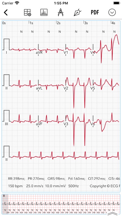 ECG / EKG screenshot-3