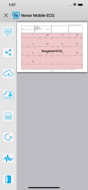 Norav Medical Mobile ECG(圖5)-速報App