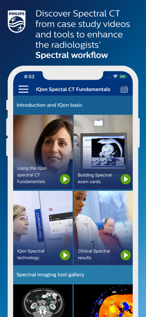 Philips IQon Spectral CT(圖1)-速報App