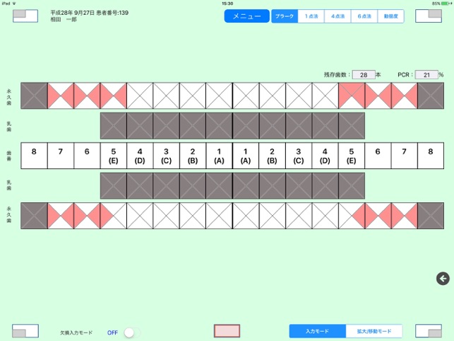 EX歯周病検査(圖3)-速報App