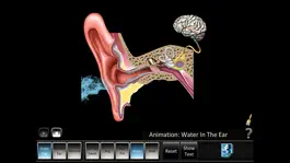 Game screenshot Ear Disorders: Outer Middle hack